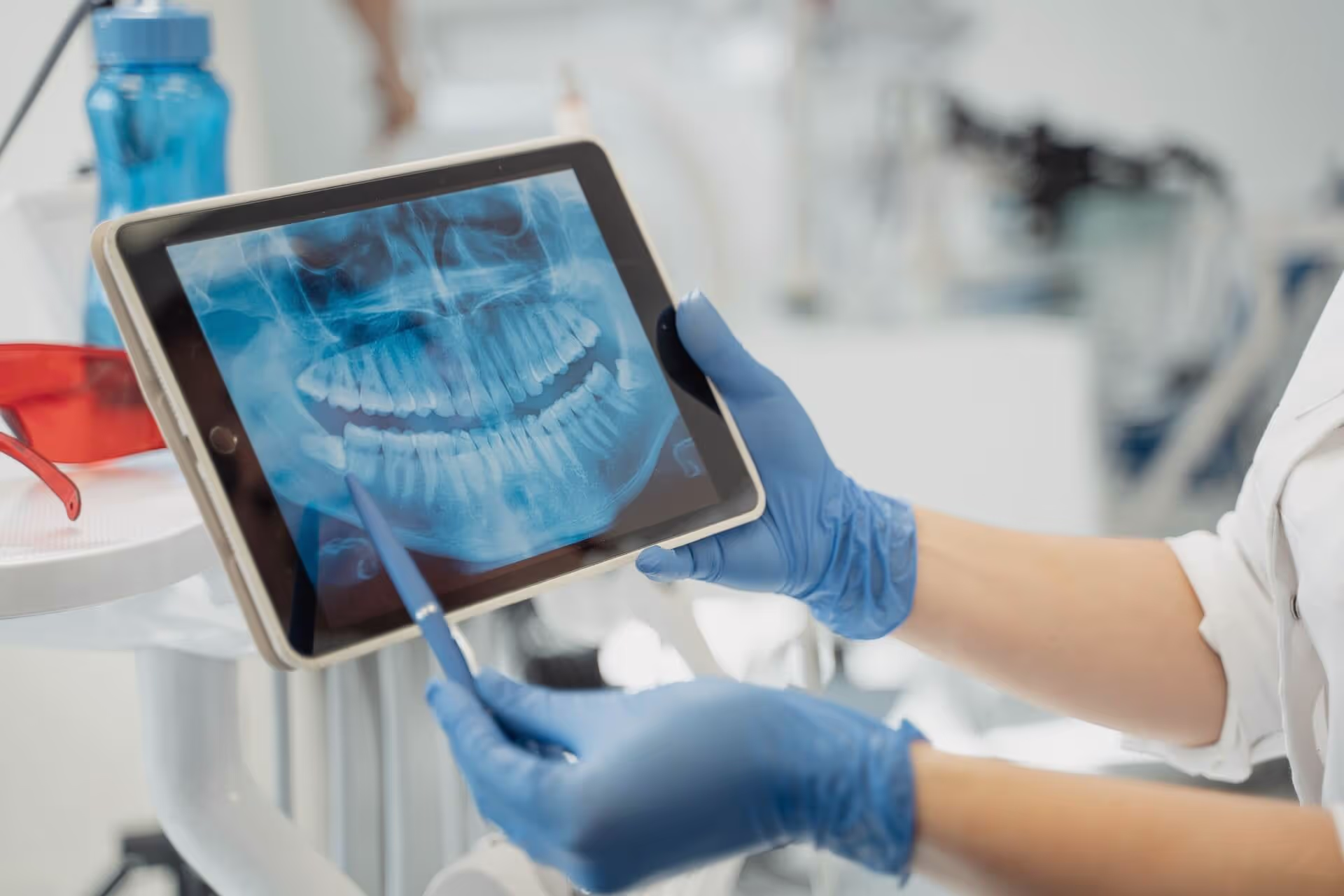 Puentes dentales fijos en DENTIKA