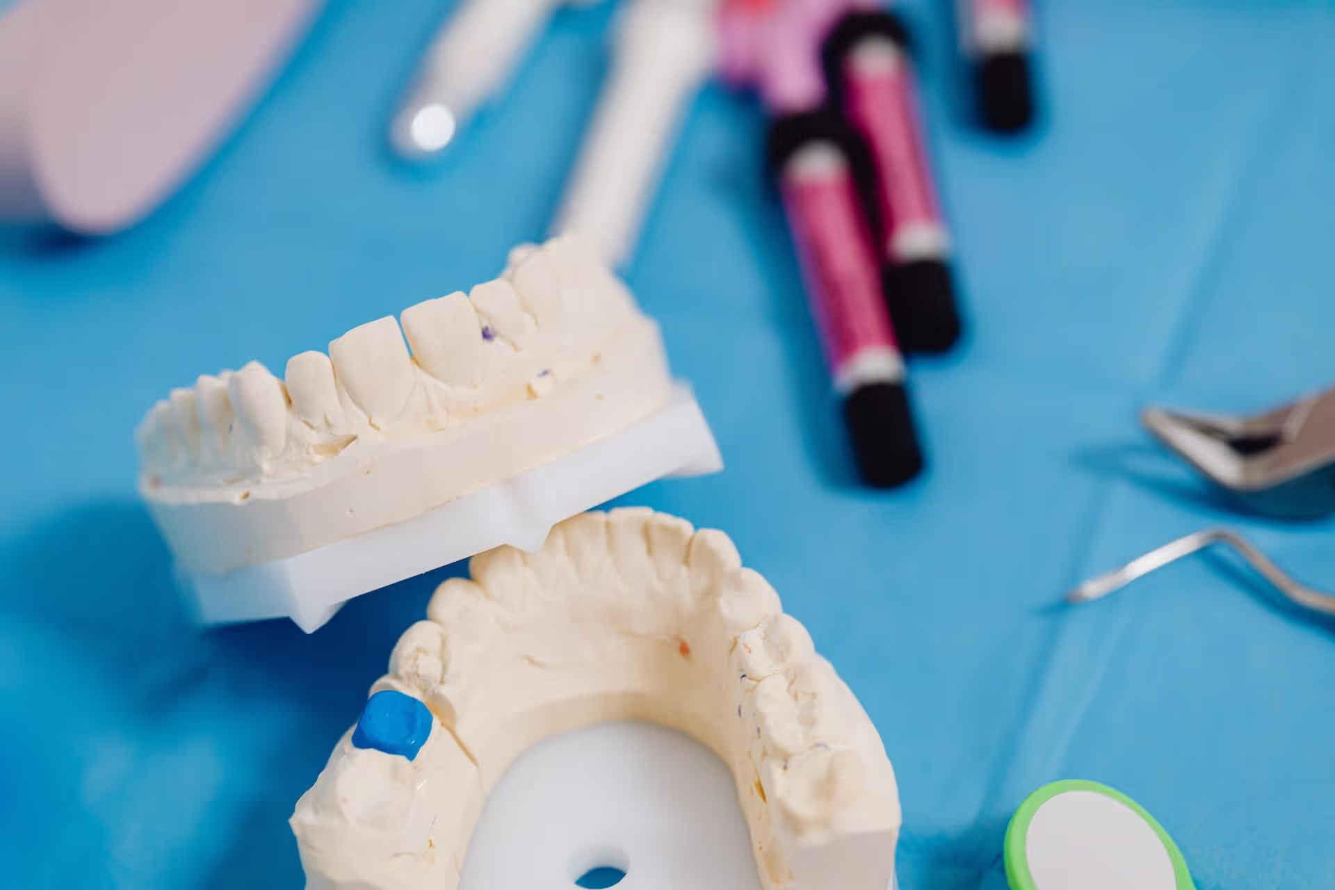 Carillas vs blanqueamiento dental